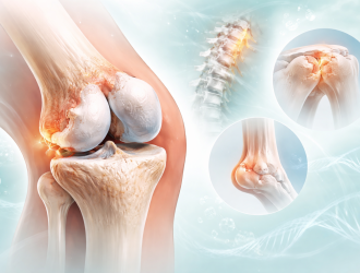 Bone Spurs – Definition, Mechanism and Applications