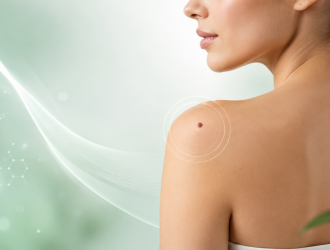 mole removal